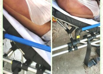 Dupla invade casa e agride homem com pedrada na cabeça em Água Branca, no PI