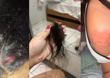 Mulher denuncia agressão durante cerimônia religiosa em terreiro de Teresina