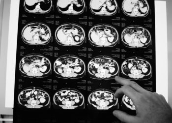 Anvisa aprova novo medicamento para câncer colorretal metastáti