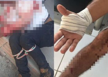 Irmãos são baleados ao reagir a assalto e conseguem imobilizar suspeito na zona rural de Barras, no Piauí